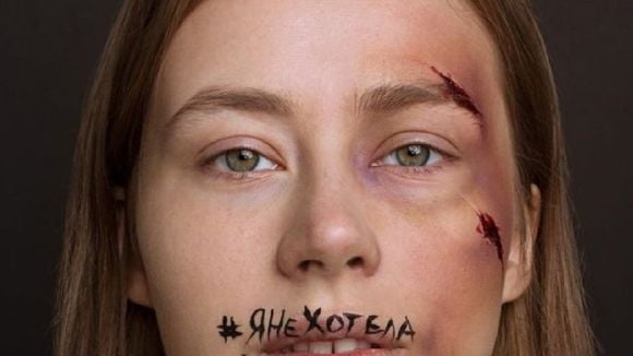 "Je ne voulais pas mourir", la campagne choc des femmes russes contre les violences conjugales