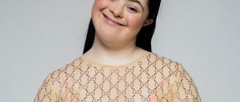 Albinisme Ces Mannequins Albinos Qui Defient Les Normes Terrafemina Albinisme Ces Mannequins Albinos Qui Defient Les Normes Terrafemina