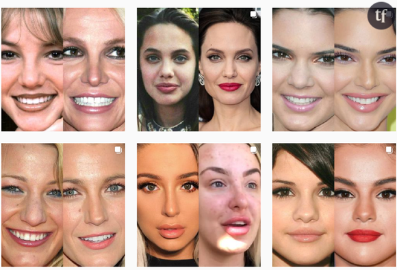"Celebrities BeforeAfter", l'un des comptes-stars recueillant les "transformations physiques" des célébrités.