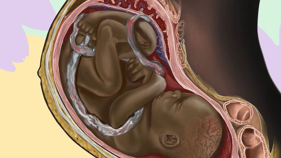 Pourquoi cette illustration d'un foetus noir est importante