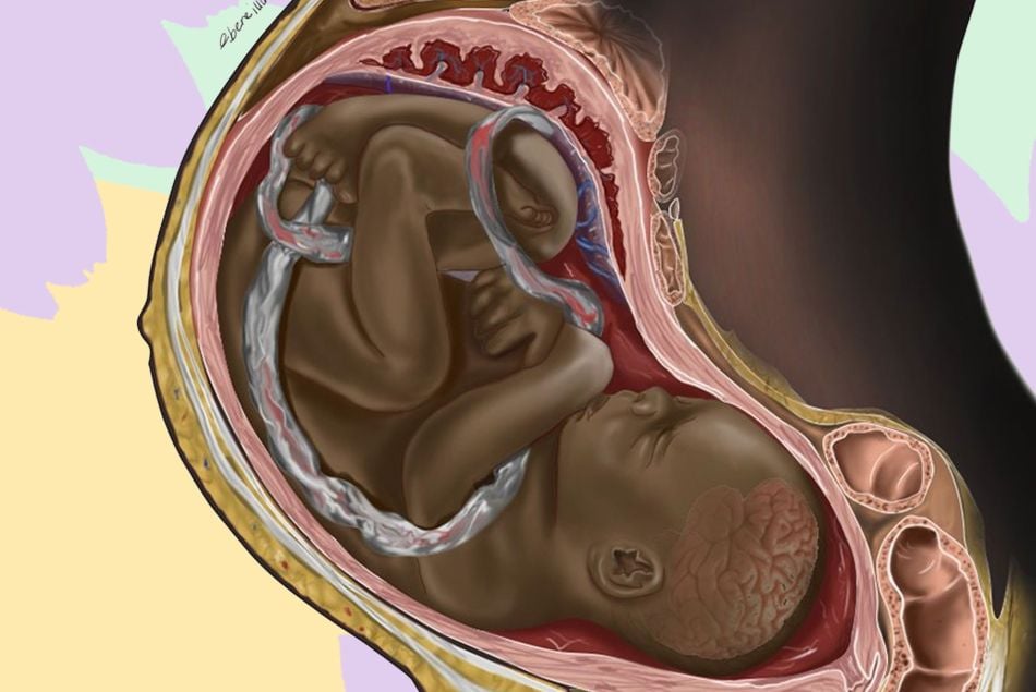 Ce dessin de foetus noir devient viral