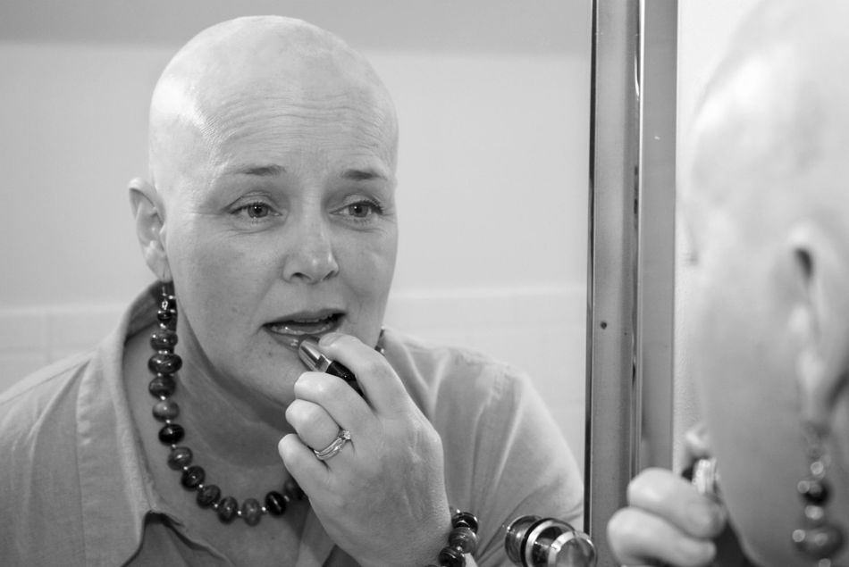 L'onco-esthétique, une interface entre la société et les malades du cancer