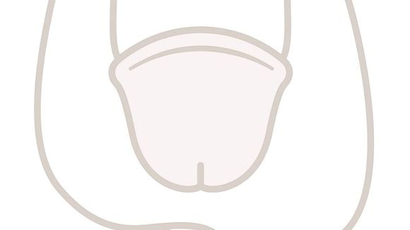 Tout savoir sur la circoncision