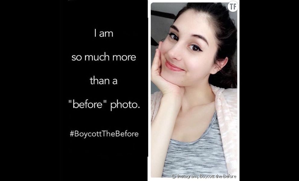 #BoycottTheBefore :  la campagne body positive qui prend de l&#039;ampleur sur Instagram 