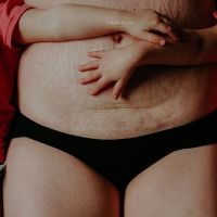 Elle photographie le corps des femmes post-accouchement pour les encourager à s'aimer