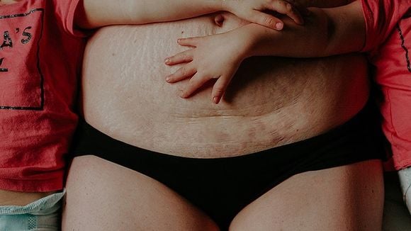 Elle photographie le corps des femmes post-accouchement pour les encourager à s'aimer