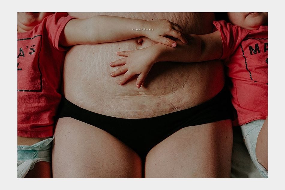 Elle photographie le corps des femmes après l'accouchement pour les encourager à s'aimer