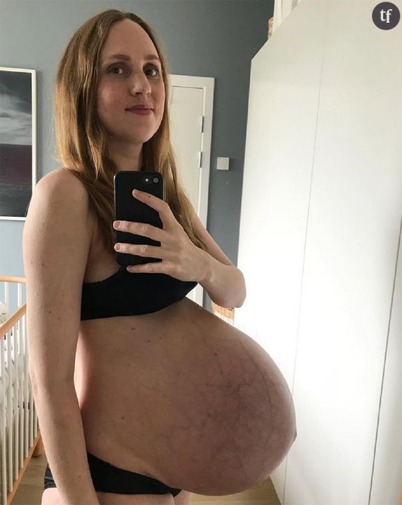 Cette maman dévoile des photos de son ventre pour montrer "la réalité" de la grossesse