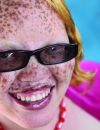 Jayne Waithera, atteinte d'albinisme.