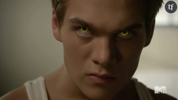 Teen Wolf saison 5 : voir l'épisode 8 "Ouroboros" en VOST