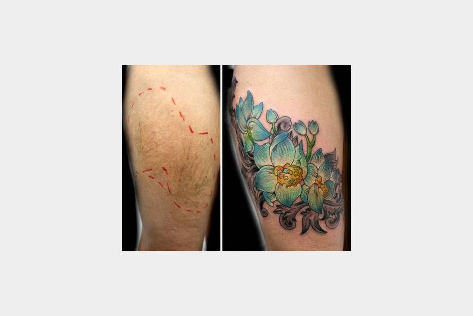 La tatoeuse Flavia Carvalho recouvre les cicatrices des femmes victimes de violences