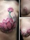 La tatoueuse recouvre aussi les cicatrices de femmes ayant subi des mastectomies