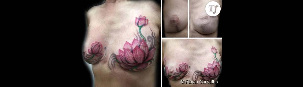 La tatoueuse recouvre aussi les cicatrices de femmes ayant subi des mastectomies