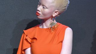 Ces mannequins atteintes d'albinisme qui défient les normes