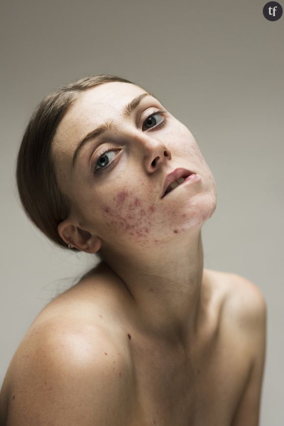 Les portraits ultra "skin positive" de Sophie Harris-Taylor.