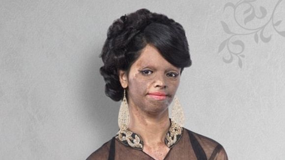 Une Indienne victime d'une attaque à l'acide devient égérie de la marque Viva N Diva