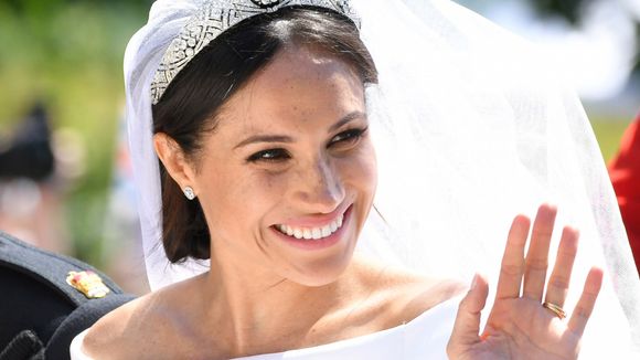 Tout le monde veut les taches de rousseur de Meghan Markle