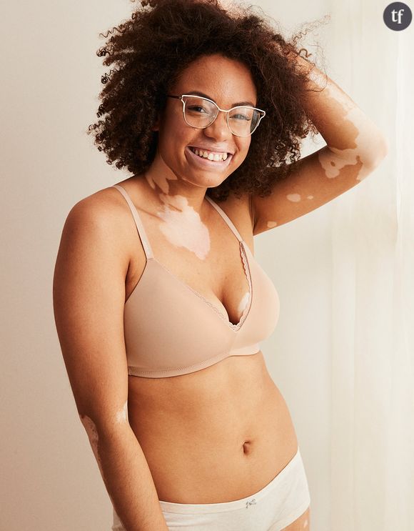 Mannequin avec vitiligo pour Aerie