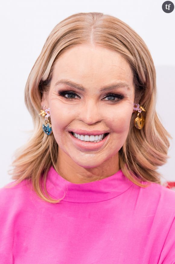 Le mannequin Katie Piper en mars 2018