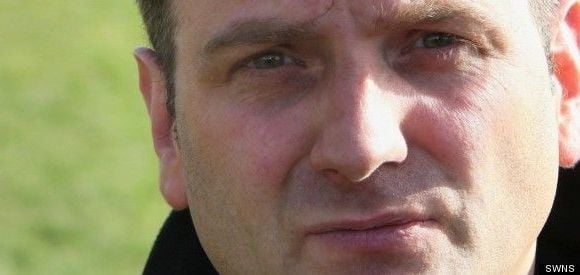 Un anglais va se faire greffer un pénis conçu avec la peau de son bras