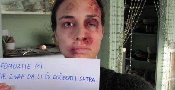 Violences conjugales : une femme battue se photographie tous les jours - vidéo