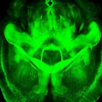 CLARITY rend le cerveau humain transparent - Vidéo