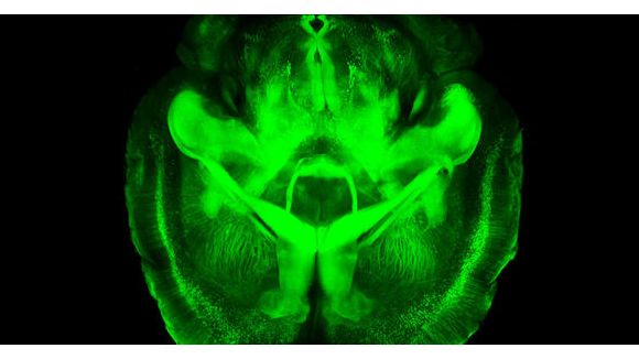 CLARITY rend le cerveau humain transparent - Vidéo