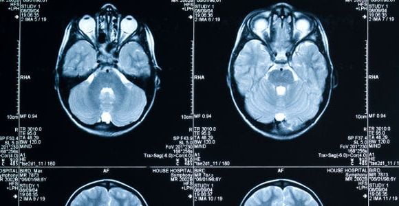 Trop d'examens inutiles selon l'Académie de médecine