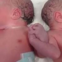 Des jumeaux espagnols se donnent la main dès la naissance - Vidéo