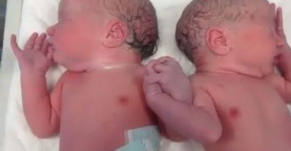 Des jumeaux espagnols se donnent la main dès la naissance - Vidéo