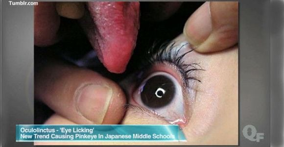 L'"eyeball licking", la nouvelle pratique sexuelle venue du Japon - vidéo