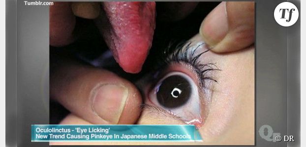 L'"eyeball licking", la nouvelle pratique sexuelle venue du Japon - vidéo