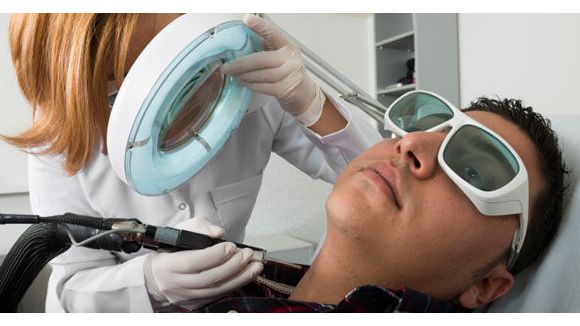 Tout savoir sur les épilations définitives pour hommes