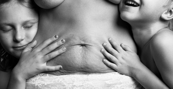 "A Beautiful Body" : des photos pour célébrer le corps après l'accouchement