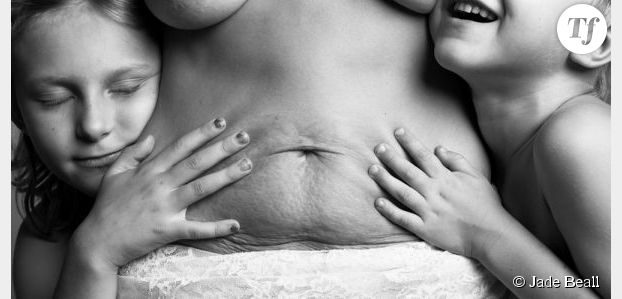 "A Beautiful Body" : des photos pour célébrer le corps après l'accouchement