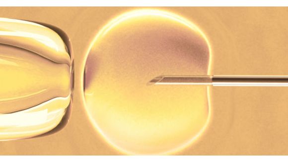 PMA : faut-il autoriser la FIV à trois ?