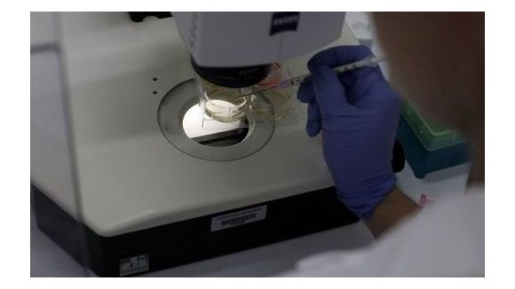 Santé : Alzheimer et cancer ne vont pas de pair