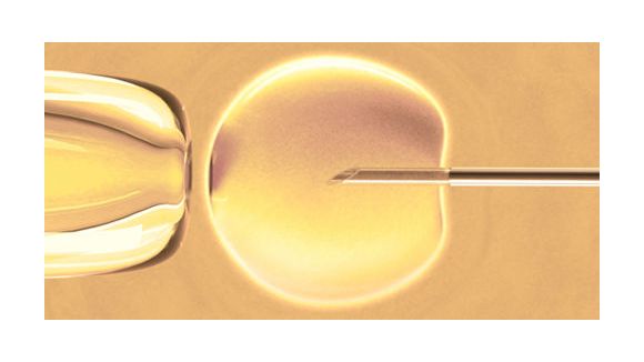 Miracle de la FIV : Un couple conçoit deux paires de vrais jumeaux