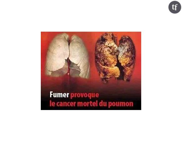 Les images chocs voire « gores» arrivent sur les paquets de cigarettes !