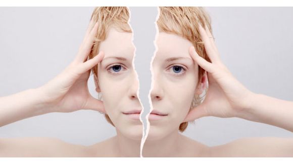 Les migraines provoquent des lésions dans le cerveau