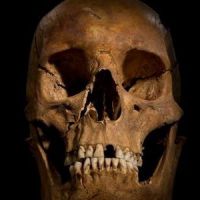 Richard III : un roi avec des vers et une mauvaise hygiène