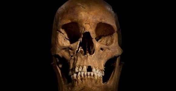 Richard III : un roi avec des vers et une mauvaise hygiène