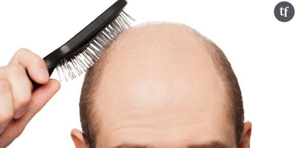 Calvitie : un traitement miracle pour faire repousser les cheveux enfin trouvé ?