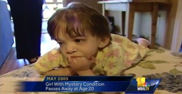 Mort de Brooke : âgée de vingt ans, elle en paraissait deux