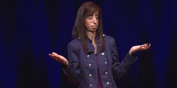 Lizzie Velásquez : "la femme la plus moche du monde" prend sa revanche