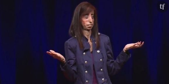 Lizzie Velásquez : "la femme la plus moche du monde" prend sa revanche