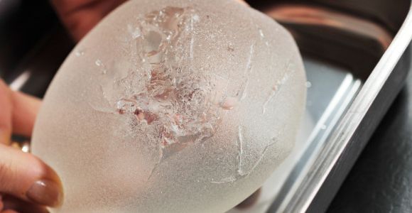 Prothèses PIP : TUV condamné à verser un minimum de 3000 euros à chaque victime