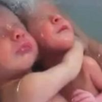 Des jumeaux prennent un bain, enlacés comme dans le ventre de leur mère