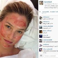 Bar Refaeli teste les injections de sang comme Kim Kardashian