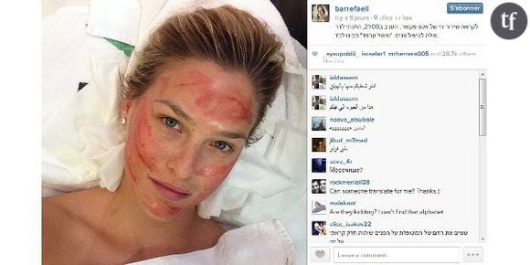 Bar Refaeli teste les injections de sang comme Kim Kardashian